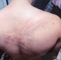 Salta: policías le hicieron la "tortura de la media sucia" y filmaron todo 